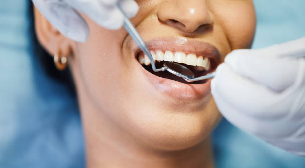 Best Emergency Root Canal Treatment in Monmouth, OR